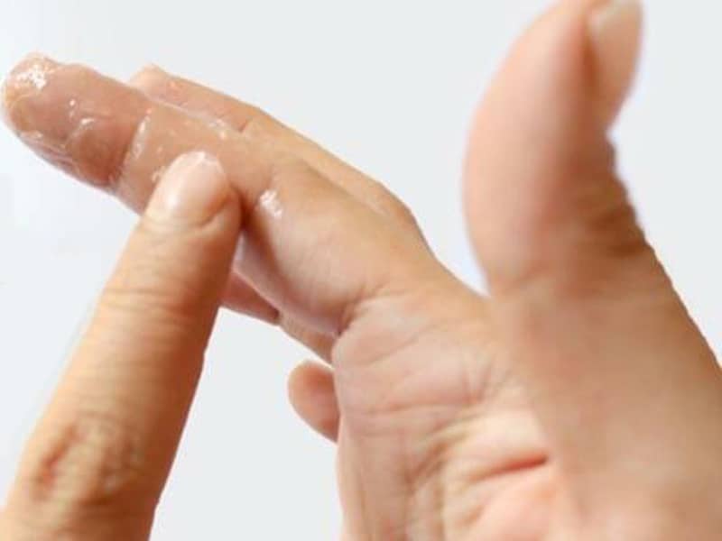 how to remove adhesive from skin