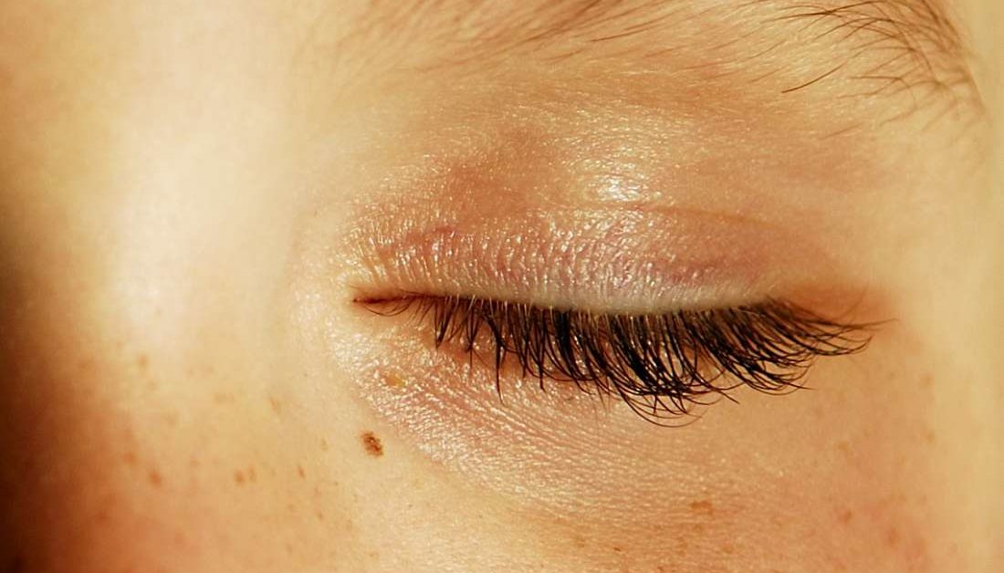 Why Does My Eye Hurt When I Blink (What You Need To Know)