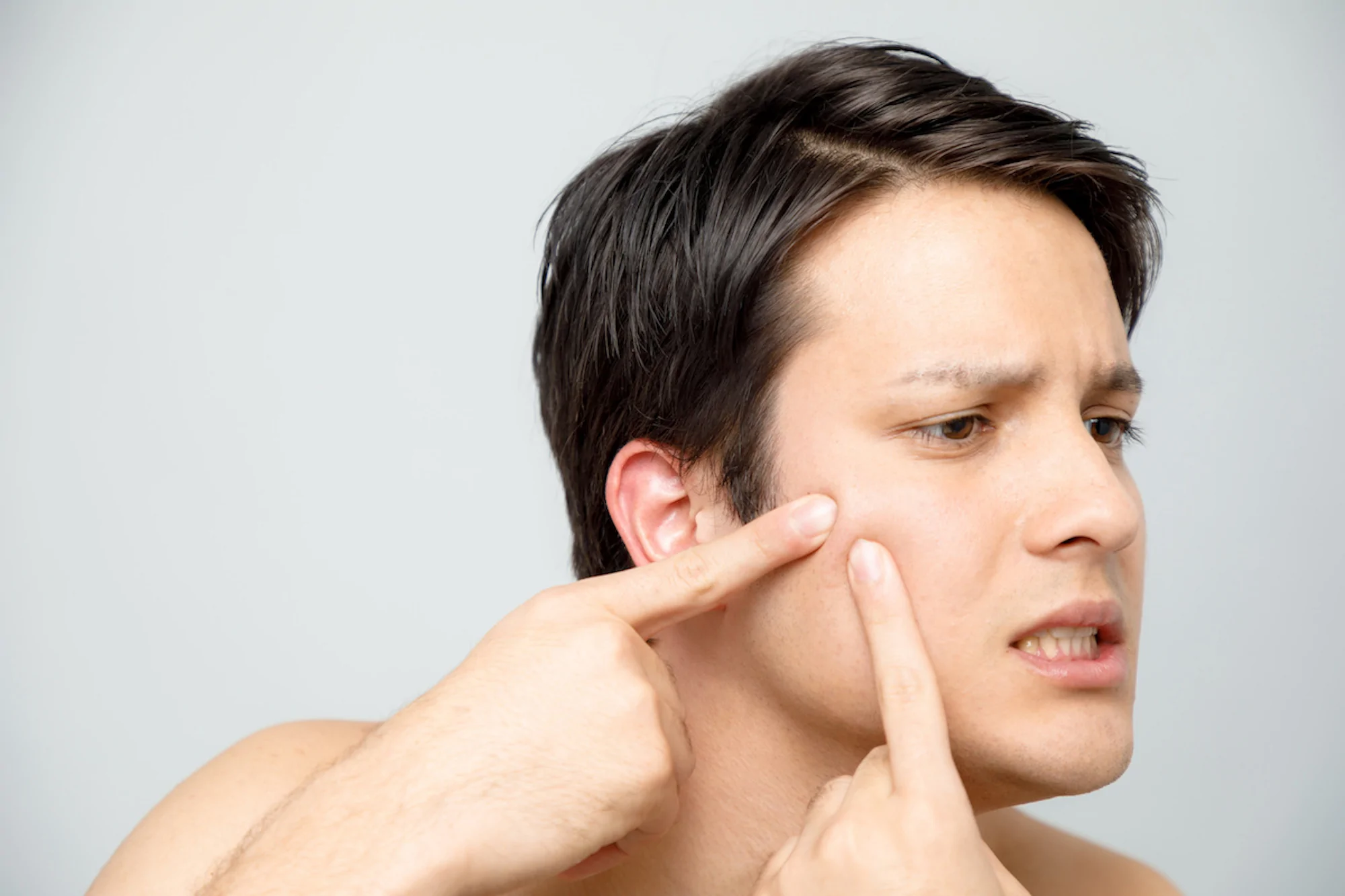 Why Do Pimples Hurt? Causes and Treatment